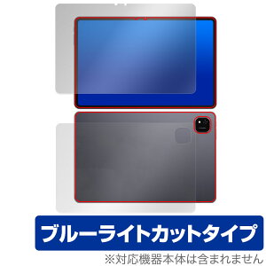 ALLDOCUBE iPlay 60 Pad Pro \ w tB OverLay Eye Protector for I[hL[u ڂɗD u[CgJbg