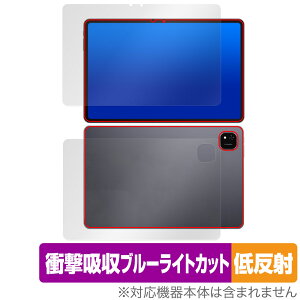 ALLDOCUBE iPlay 60 Pad Pro \ w tB OverLay Absorber ᔽ for I[hL[u Ռz u[CgJbg R