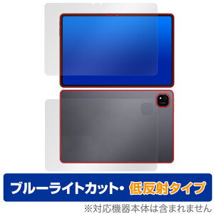 ALLDOCUBE iPlay 60 Pad Pro \ w tB OverLay Eye Protector ᔽ for I[hL[u u[CgJbg ˖h~