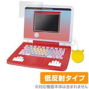 |PsJbƃAJf~[ |PQbgp\REX ی tB OverLay Plus tی A`OA ˖h~  wh~