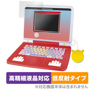 |PsJbƃAJf~[ |PQbgp\REX ی tB OverLay Plus Lite ׉tΉ A`OA ˖h~ 