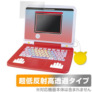 |PsJbƃAJf~[ |PQbgp\REX ی tB OverLay Plus Premium A`OA ˖h~  wh~