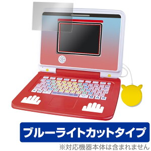 |PsJbƃAJf~[ |PQbgp\REX ی tB OverLay Eye Protector tی ڂɗD u[CgJbg