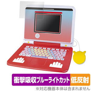 |PsJbƃAJf~[ |PQbgp\REX ی tB OverLay Absorber ᔽ Ռz u[CgJbg R