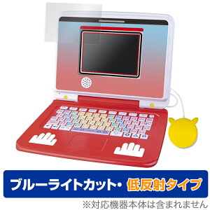 |PsJbƃAJf~[ |PQbgp\REX ی tB OverLay Eye Protector ᔽ u[CgJbg ˖h~