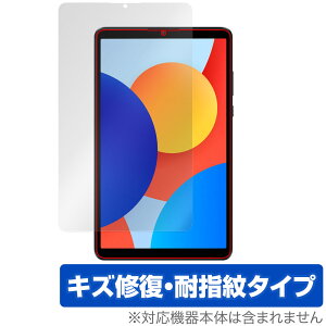 Xiaomi Redmi Pad SE 8.7 4G SE 8.7 ی tB OverLay Magic for VI~[ ^ubg C ώw wh~ R[eBO