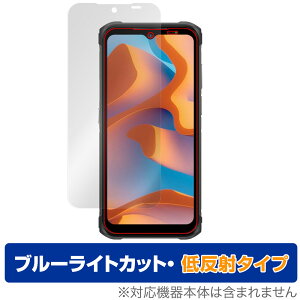 Ulefone Armor 12S �ی� �t�B���� OverLay Eye Protector �ᔽ�� for �E���t�H�� �X�}�[�g�t�H�� �t���ی� �u���[���C�g�J�b�g ���˖h�~