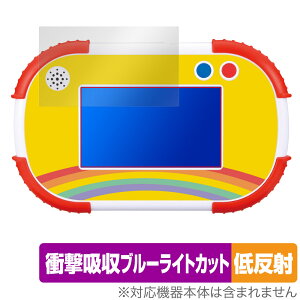 �^�b�`�łł����I1.5�˂���̃A���p���}���m��p�b�h �ی� �t�B���� OverLay Absorber �ᔽ�� �Ռ��z�� ���˖h�~ �u���[���C�g�J�b�g �R��