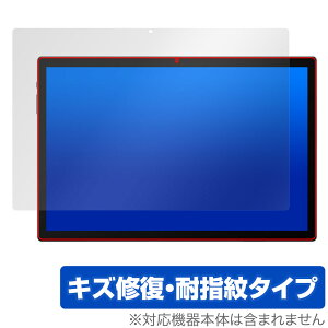 MESWAO B2 ی tB OverLay Magic for  ^ubg 14C` tی C ώw wh~ R[eBO