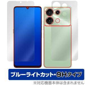 UMIDIGI G9 5G \ w tB OverLay Eye Protector 9H for ~fBW X}z \ wʃZbg 9H dx u[CgJbg