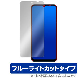 UMIDIGI A15T ی tB OverLay Eye Protector ~fBW X}[gtH tی ڂɗD u[CgJbg