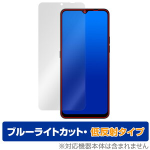 UMIDIGI A15T ی tB OverLay Eye Protector ᔽ ~fBW X}[gtH tی u[CgJbg ˖h~