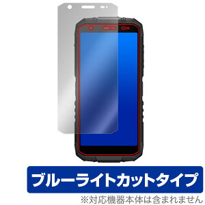 DOOGEE S41 Max / DOOGEE S41 ی tB OverLay Eye Protector for hD[W[ X}[gtH ڂɗD u[CgJbg