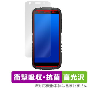 DOOGEE S41 Max / DOOGEE S41 ی tB OverLay Absorber  for hD[W[ X}[gtH Ռz R