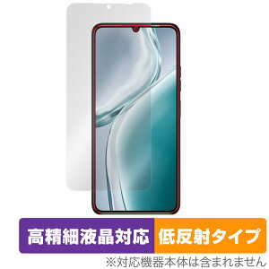 OUKITEL C50 ی tB OverLay Plus Lite for IELe X}[gtH ׉tΉ A`OA ˖h~  wh~