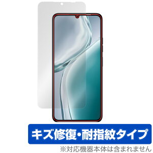 OUKITEL C50 ی tB OverLay Magic for IELe X}[gtH tی C ώw wh~ R[eBO