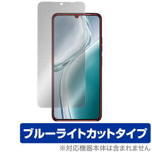 OUKITEL C50 ی tB OverLay Eye Protector for IELe X}[gtH tی ڂɗD u[CgJbg