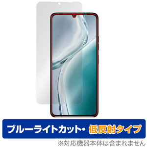 OUKITEL C50 ی tB OverLay Eye Protector ᔽ for IELe X}[gtH tی u[CgJbg ˖h~