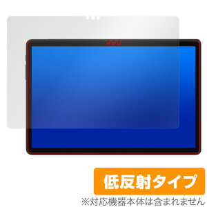 ALLDOCUBE iPlay 60S ی tB OverLay Plus for I[hL[u ^ubg tی A`OA ˖h~  wh~