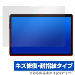 ALLDOCUBE iPlay 60S ی tB OverLay Magic for I[hL[u ^ubg tی C ώw wh~ R[eBO