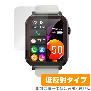 Nexmora X}[gEHb` F18 3 ی tB OverLay Plus for jOEHb` A`OA ˖h~  wh~