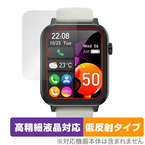 Nexmora X}[gEHb` F18 3 ی tB OverLay Plus Lite for jOEHb` ׉tΉ A`OA wh~