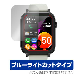 Nexmora X}[gEHb` F18 3 ی tB OverLay Eye Protector for jOEHb` ڂɗD u[CgJbg