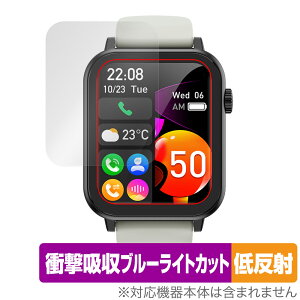 Nexmora X}[gEHb` F18 3 ی tB OverLay Absorber ᔽ for jOEHb` Ռz u[CgJbg