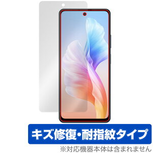 Blackview OSCAL TIGER 12 �ی� �t�B���� OverLay Magic for �u���b�N�r���[ �I�X�J�� �t���ی� ���C�� �ώw�� �w��h�~ �R�[�e�B���O