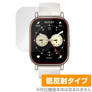 Xiaomi Redmi Watch 5 Lite ی tB OverLay Plus for VI~[ X}[gEHb` A`OA ˖h~  wh~