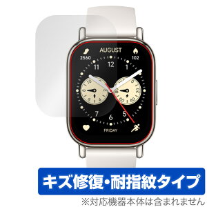 Xiaomi Redmi Watch 5 Lite ی tB OverLay Magic for VI~[ X}[gEHb` C ώw wh~ R[eBO