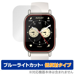 Xiaomi Redmi Watch 5 Lite ی tB OverLay Eye Protector ᔽ for VI~[ X}[gEHb` u[CgJbg ˖h~