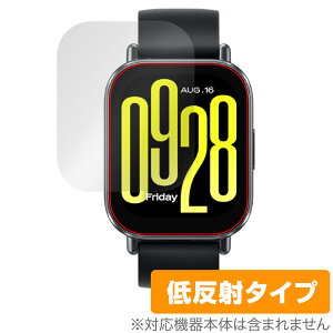 Xiaomi Redmi Watch 5 Active ی tB OverLay Plus for VI~[ X}[gEHb` A`OA ˖h~  wh~