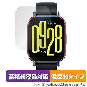 Xiaomi Redmi Watch 5 Active ی tB OverLay Plus Lite for VI~[ X}[gEHb` ׉tΉ A`OA wh~