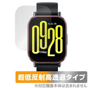Xiaomi Redmi Watch 5 Active ی tB OverLay Plus Premium for VI~[ X}[gEHb` A`OA  wh~