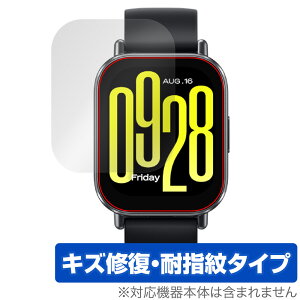 Xiaomi Redmi Watch 5 Active ی tB OverLay Magic for VI~[ X}[gEHb` C ώw wh~ R[eBO