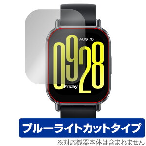 Xiaomi Redmi Watch 5 Active ی tB OverLay Eye Protector for VI~[ X}[gEHb` ڂɗD u[CgJbg