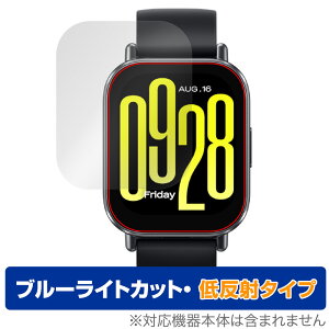 Xiaomi Redmi Watch 5 Active ی tB OverLay Eye Protector ᔽ for VI~[ X}[gEHb` u[CgJbg