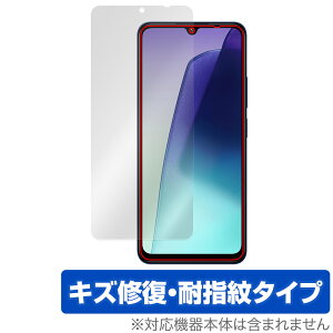 Xiaomi Redmi 14C ی tB OverLay Magic for VI~ h~ tی C ώw wh~ R[eBO