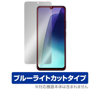 Xiaomi Redmi 14C ی tB OverLay Eye Protector for VI~ h~ tی ڂɗD u[CgJbg