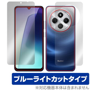 Xiaomi Redmi 14C \ w tB OverLay Eye Protector for VI~ h~ ڂɗD u[CgJbg