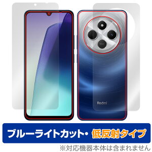 Xiaomi Redmi 14C \ w tB OverLay Eye Protector ᔽ for VI~ h~ u[CgJbg ˖h~