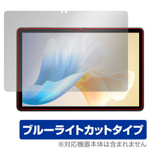 OUKITEL OT11 ی tB OverLay Eye Protector for IELe ^ubg tی ڂɗD u[CgJbg