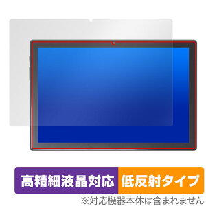 KADYBE D115 ی tB OverLay Plus Lite for 2in1^ubg tی ׉tΉ A`OA ˖h~  wh~