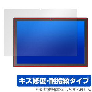 KADYBE D115 ی tB OverLay Magic for 2in1^ubg tی C ώw wh~ R[eBO