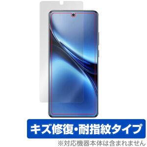 vivo X200 Pro �ی� �t�B���� OverLay Magic for ���B�[���H �X�}�[�g�t�H�� �t���ی� ���C�� �ώw�� �w��h�~ �R�[�e�B���O