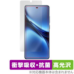 vivo X200 Pro �ی� �t�B���� OverLay Absorber ������ for ���B�[���H �X�}�[�g�t�H�� �Ռ��z�� ������ �R��