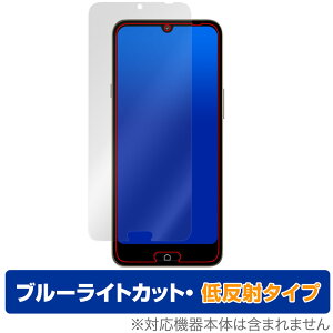 炭炭X}[gtH a A401FC Lite MR01 ی tB OverLay Eye Protector ᔽ for X}z u[CgJbg ˖h~