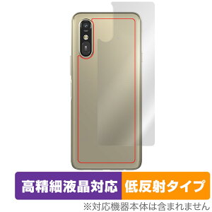 炭炭X}[gtH a A401FC Lite MR01 w ی tB OverLay Plus Lite for X}z {̕ی 炳G ᔽ