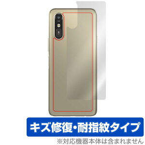 炭炭X}[gtH a A401FC Lite MR01 w ی tB OverLay Magic for X}z {̕ی C wh~ R[eBO